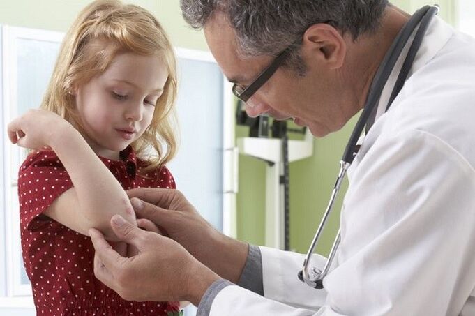 le psoriasis à un âge précoce